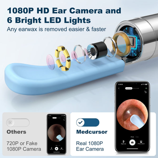 Ear Wax Removal, Ear Wax Removal Tool Camera with 1080P HD Smart Visual Otoscope, Ear Cleaner with 6 LED Lights and 6 Soft Ear Scoops for iOS & Android