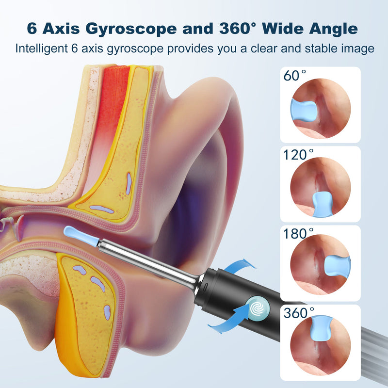 Ear Wax Removal, Ear Wax Removal Tool Camera with 1080P HD Smart Visual Otoscope, Ear Cleaner with 6 LED Lights and 6 Soft Ear Scoops for iOS & Android